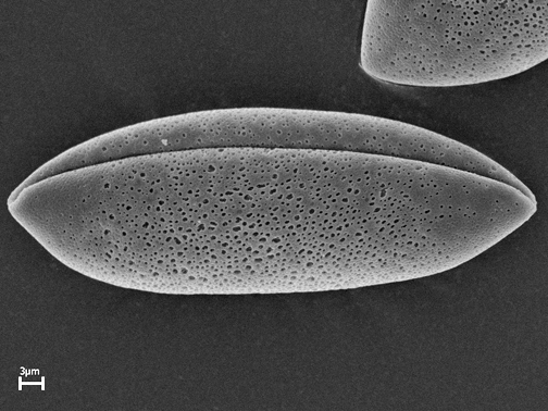 Scanning electron microscope image of pollen. Hyacinthoides hispanica white flower. Scanning electron microscope image of pollen. Hyacinthoides hispanica white flower.