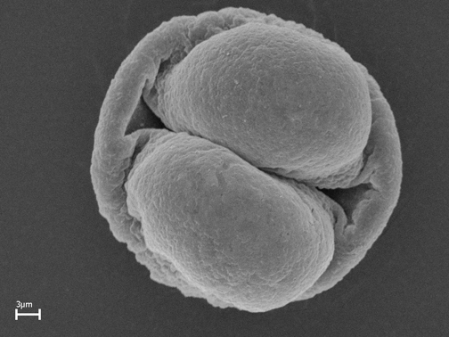 Scanning electron microscope image of pollen grain. Scanning electron microscope image of pollen grain.